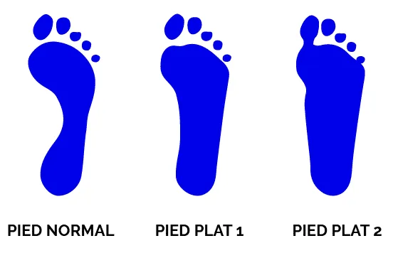 Comment savoir si on a le pied plat ?
